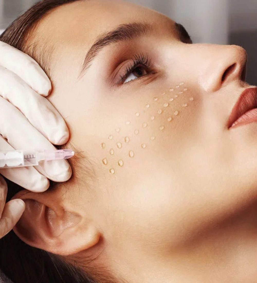 mesotherapy carlow