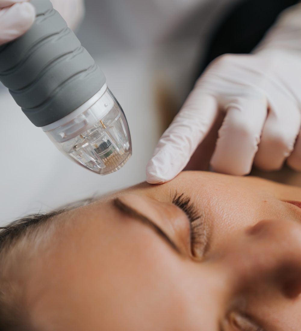 Microneedle RF lifting in a beauty salon. Big plan.